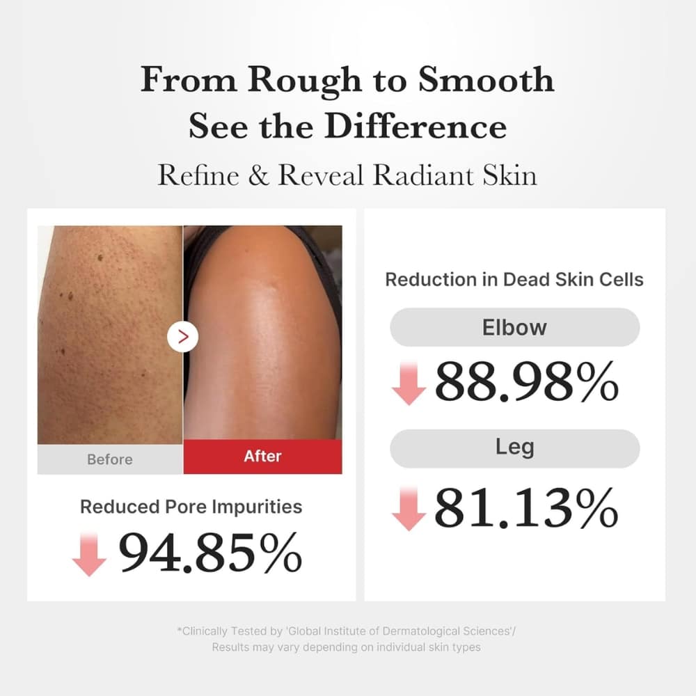 Infographic showing skincare results: left panel compares before and after arm skin with reduced pore impurities (94.85%); right panel lists dead skin cell reductions for elbow (88.98%) and leg (81.13%), with a small disclaimer about clinical testing.